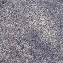 DDX42 Antibody, Novus Biologicals:Antibodies:Primary Antibodies